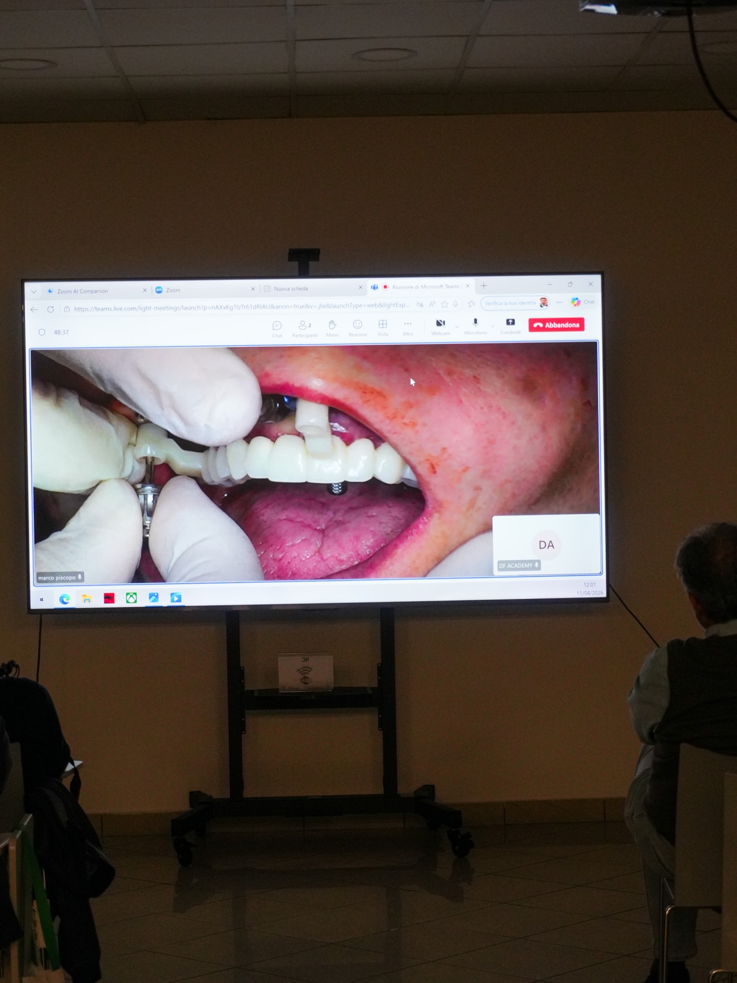 Diretta streaming dell'intervento chirurgico guidato